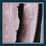 Peter Kurz  Der Letzte Rost